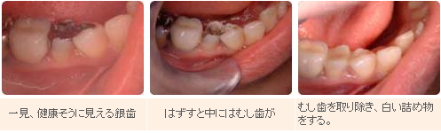 審美歯科 審美歯科