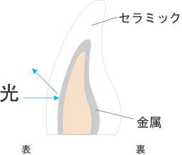 メタルボンド メタルボンド